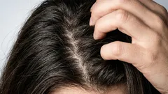 Hoe kom je thuis zelf van vet haar af?